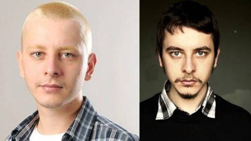 Pis Yedili dizisinin PC'si idi! Herkes onu albino hastası sanıyordu: Gerçek çok farklı çıktı! 5